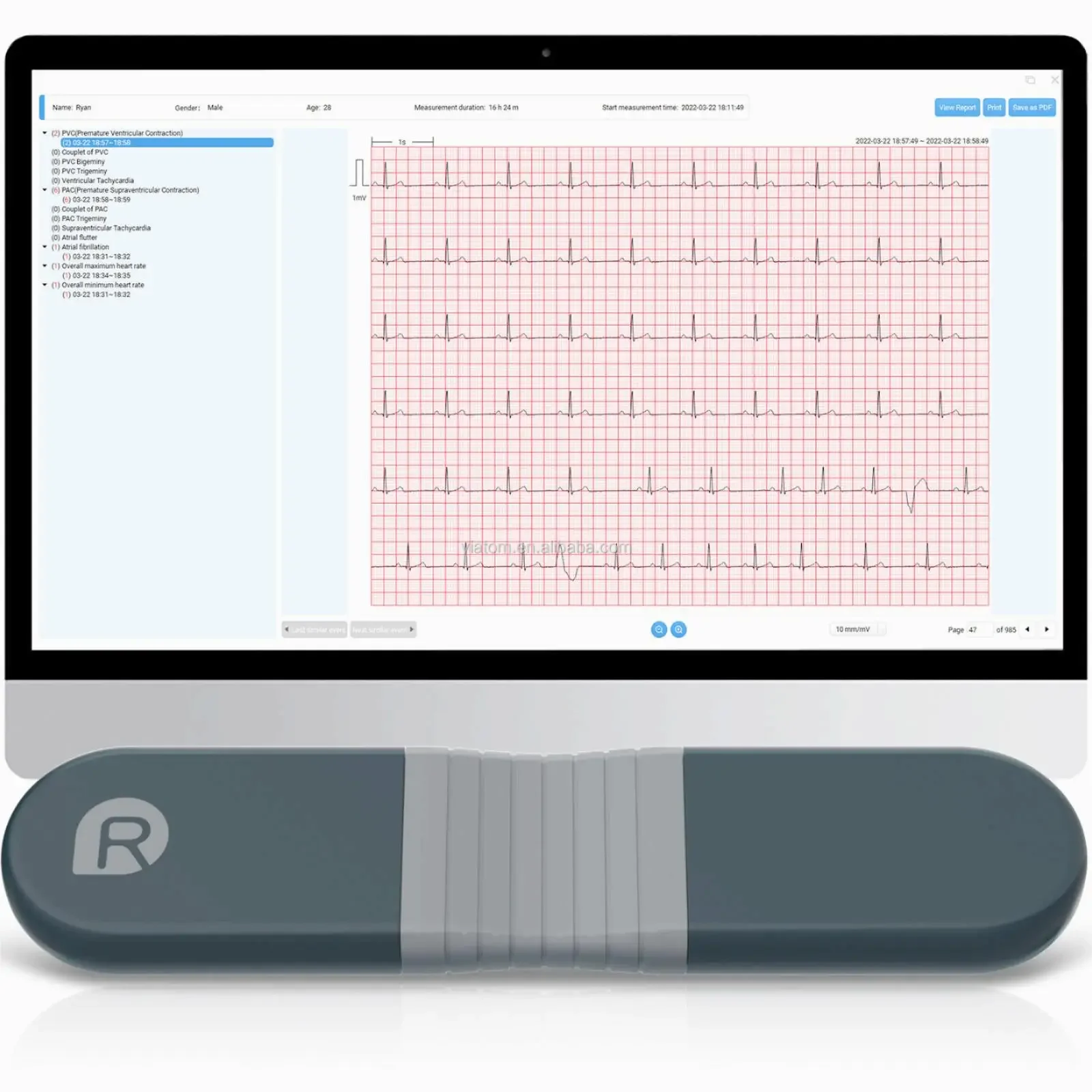 Wireless Bluetooth Dynamic Rec - Ecg Patch Monitor 리뷰 및 가격